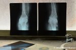 Orthopaedic X-Rays